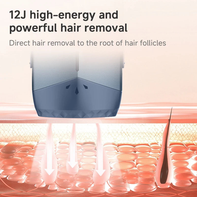 Mlay T18 Unlimited Shots IPL Hair Removal