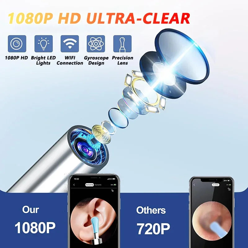 Smart Ear Cleaner